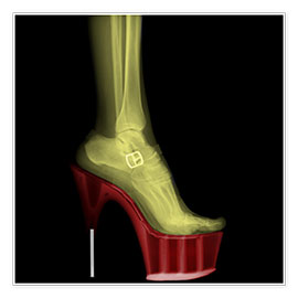 Poster  X-ray Stiletto High-Heeled Shoe - PhotoStock-Israel