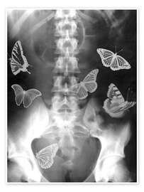Poster  Farfalle nello stomaco - PhotoStock-Israel